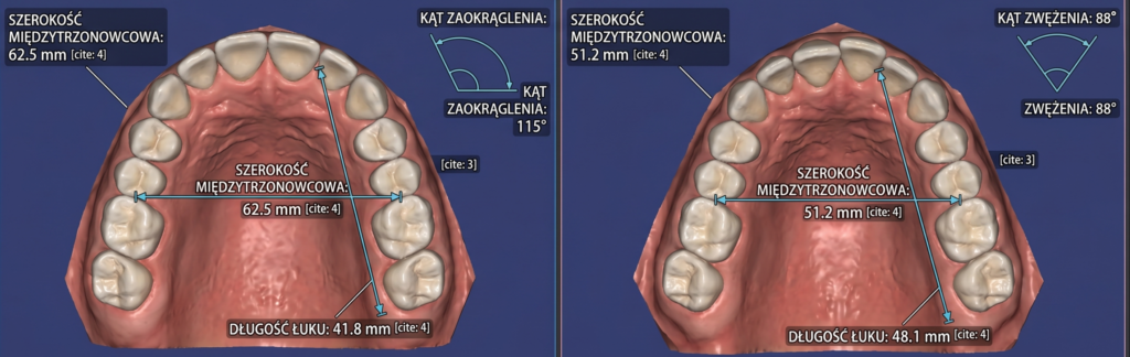 ułożenie zębów u kształtne i v kształtne